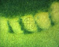WEREWOLF OF LONDON - Microscopic photo of the werewolf's lower teeth. (Poster)